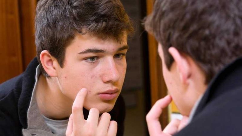 حسب موقعها على الوجه