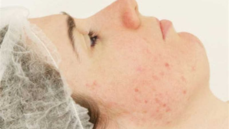 بدون تكاليف.. تخلصى