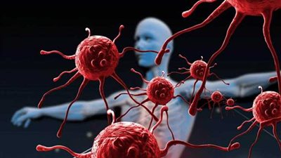 كيف تكتشف أعراض السرطان قبل خمس سنوات من المرض؟