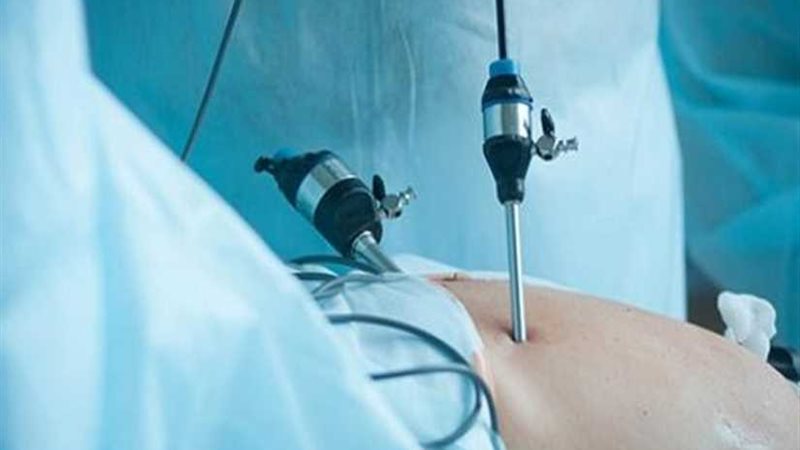  المنظار الرحمي..