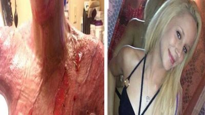 تعرضت للأغتصاب فاحرقت نفسها