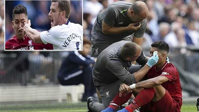 ليفربول: تقييم حالة فيرمينو بعد تعرضه لإصابة في العين