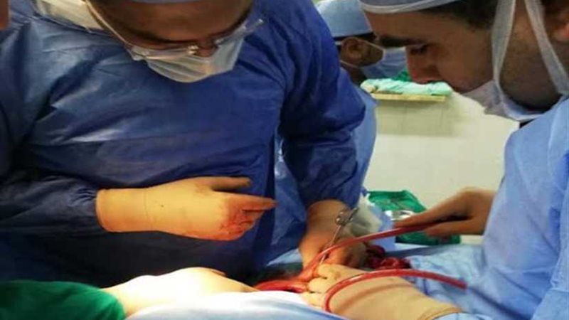 جراحة دقيقة لسيدة