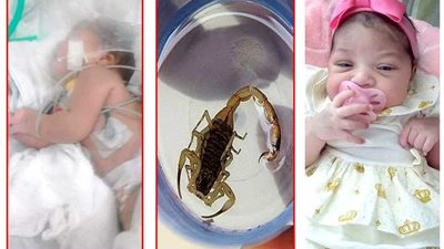 عقرب يلدغ طفلة عمرها 3 أيام (صور)