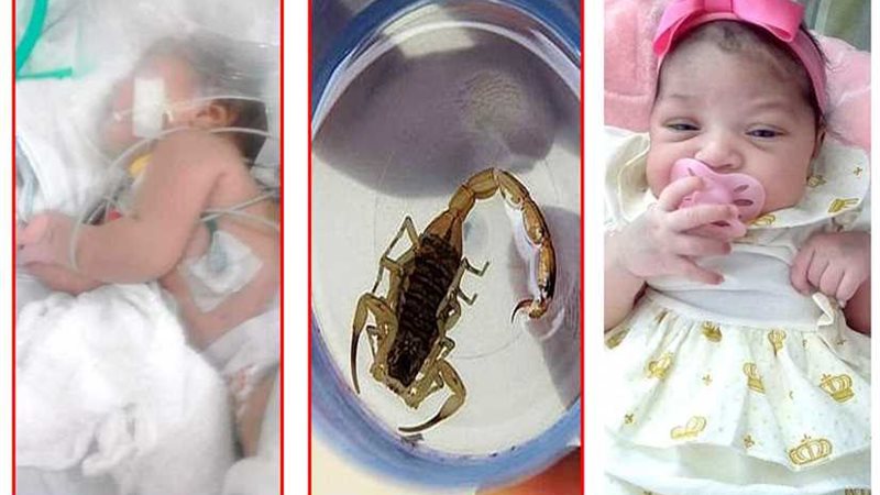 عقرب يلدغ طفلة عمرها