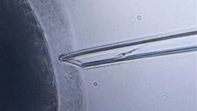 أول حالة حمل 