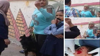 تطلق كلبًا لعقر تلميذ تشاجر مع ابنتها بالإسكندرية (صور)