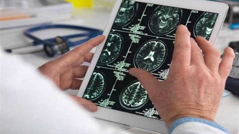 كيف يتفاعل الدماغ