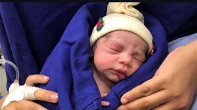 للمرة الأولى.. ولادة طفلة بعد زراعة رحم امرأة متوفاة (صور)