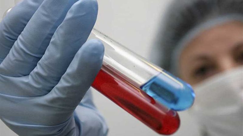 طفرة طبية... فريق