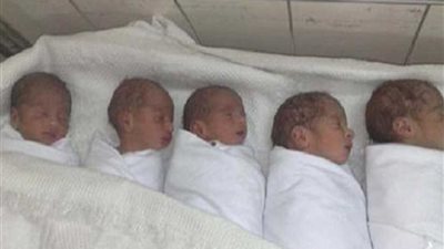 سيدة تضع 5 توائم بالمستشفى الجامعي بقنا