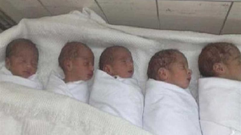 سيدة تضع 5 توائم