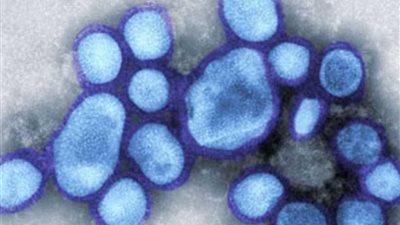 وفاة 40 شخصا جراء الإصابة بانفلونزا الخنازير بولاية 