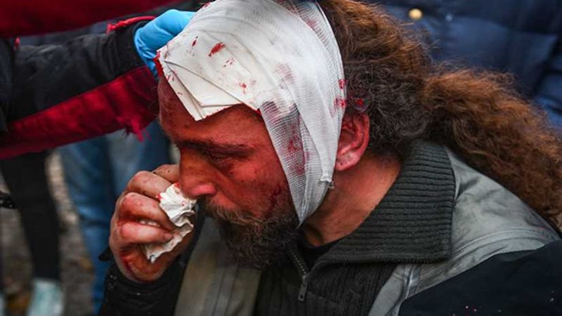 إصابة مراسل في وكالة