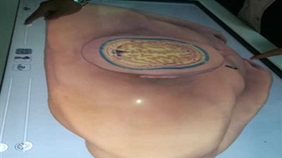 عرضًا ثلاثي الأبعاد لتشريح جسم الإنسان لطلاب طب بنها