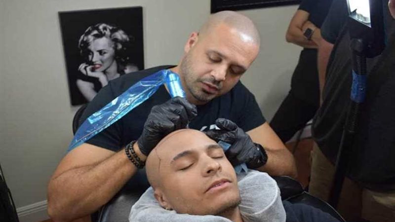 سيف صدقي.. حارب الصلع