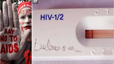بذات العلاج.. اختفاء فيروس الإيدز من ثالث مريض في العالم