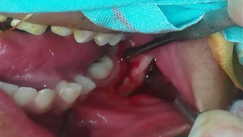 التأمين الصحي ببنها