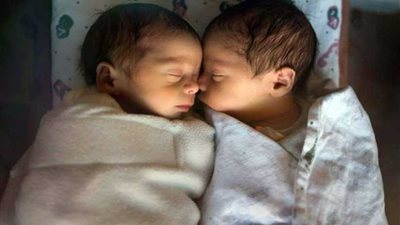الحامض النووي يكشف ولادة أم لطفلين توأم من أبوين مختلفين