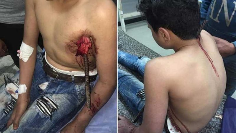 طوارئ طب طنطا يستخرج