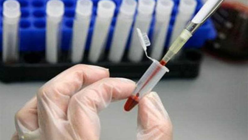 إصابة 1250 تلميذا