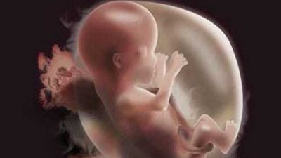 صور تكشف كيف يتغير رأس الجنين أثناء الولادة