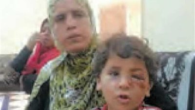 بالأرقام خلال4 أشهر.. 6241 مواطنا ضحية عقر الكلاب الضالة بـ«المنوفية»