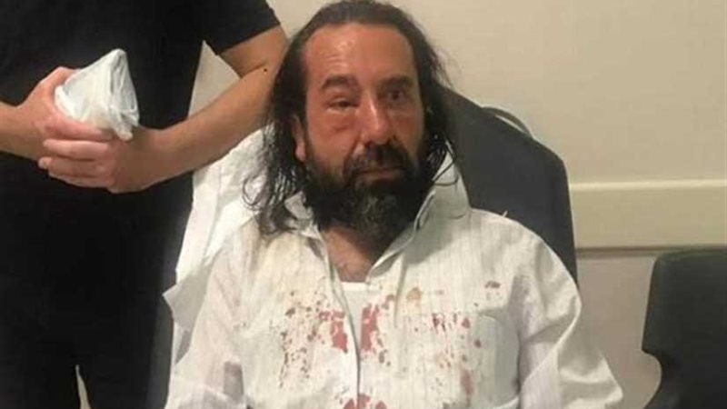 أنصار أردوغان يسحلون