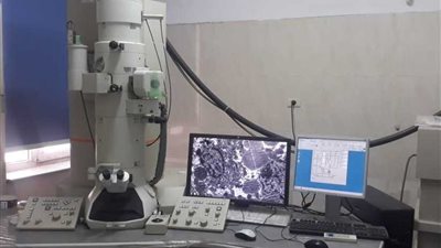 وحدة ميكروسكوب إلكتروني بمستشفى بنها الجامعي