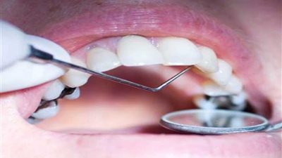 كبسولة لحماية أسنان لاعبي المنتخب في أمم إفريقيا