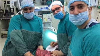 استئصال ورم سرطاني بالرحم 11 كيلو بأورام طنطا