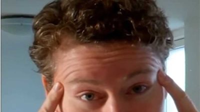 بعد الثلاثين..التجاعيد تُنذرك بهذه الأمراض