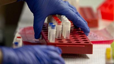 16 إصابة جديدة بمرض قاتل في أمريكا