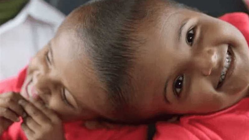 أكثر من 30 جراحا