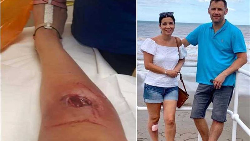 تفاصيل مأساة أم لدغها