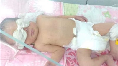 صحة المنوفية: مخالفات إدارية بالمستشفي المتسببة في بتر ذراع رضيع..وننتظر قرار المحافظ بالغلق