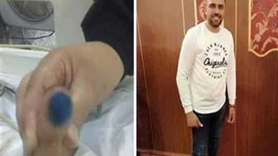 جامعة المنصورة تكشف سبب وفاة صاحب 