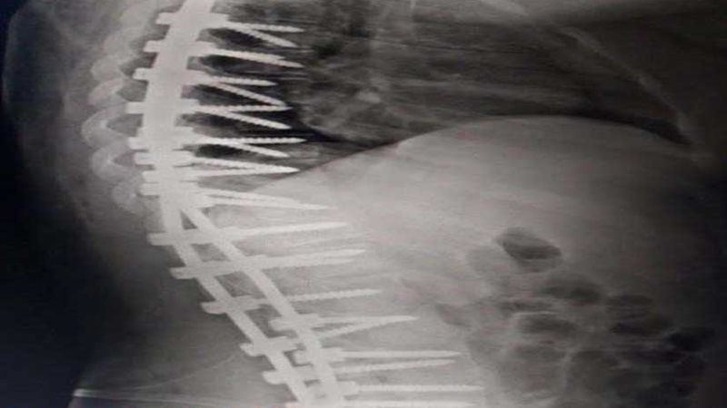 فريق طبي ينجح في