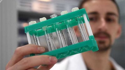 العلماء: هرمون طبيعي يقي من الأورام السرطانية