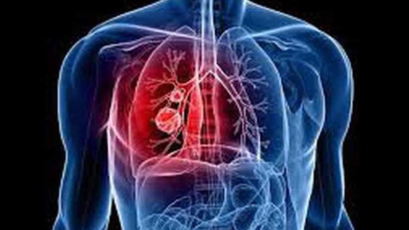 علماء: المواد الغذائية