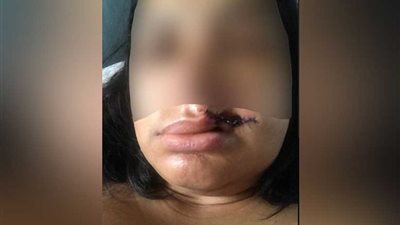 مختل يصف نفسه بالشيطان «يقضم» شفة فتاة