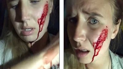 الإسبان يطلقون النار على بريطانية بسبب الأرانب.. (فيديو وصور)