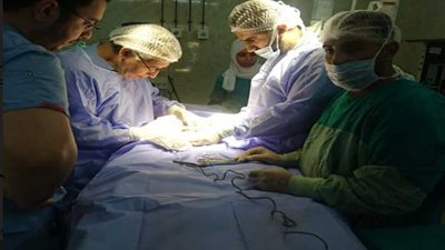 إجراء عمليات التشوهات الخلقية للأطفال لأول مرة بصحة الشرقية