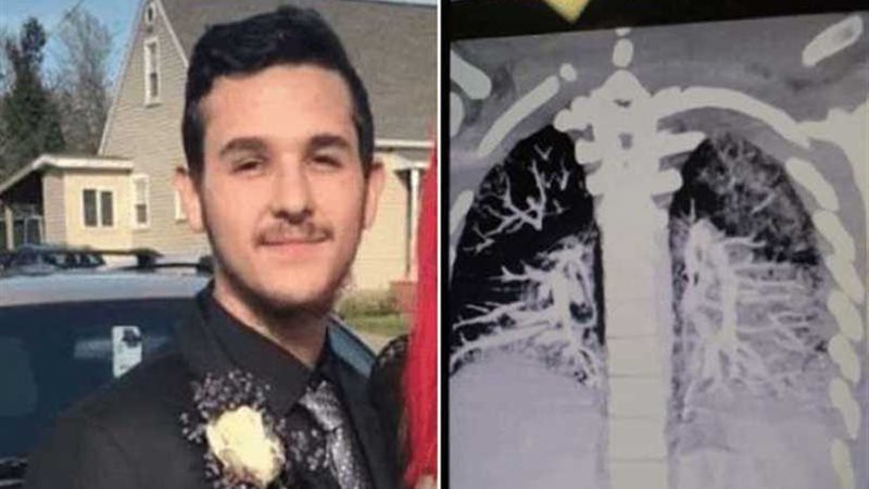 بالأشعة.. شاهد ماذا