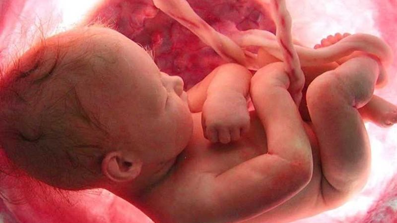جنين في بطن أمه حالة