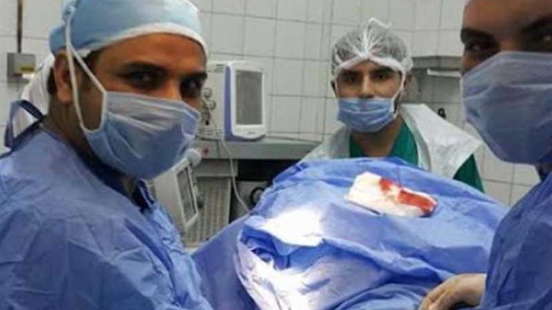 نجاح جراحة تغيير