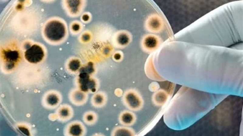 انتشار فيروسات وميكروبات