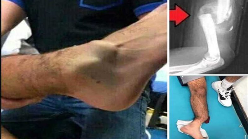 فيديو مروع.. كيف