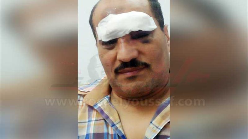 السكة الحديد: إصابة