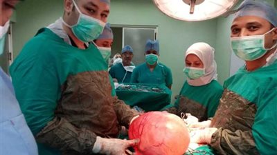 يزن 25 كيلو.. استئصال ورم من رحم سيدة ببني سويف (صور)